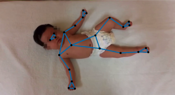 A picture of a baby lying on its back on a white sheet.