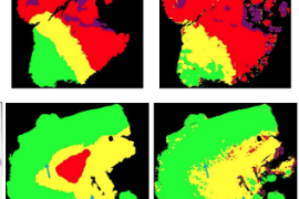 CaseStudy heroimage BrainTumor