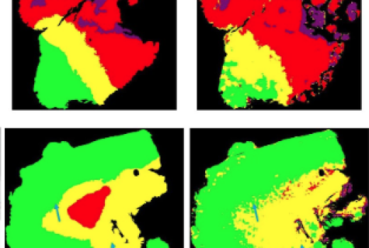 CaseStudy heroimage BrainTumor